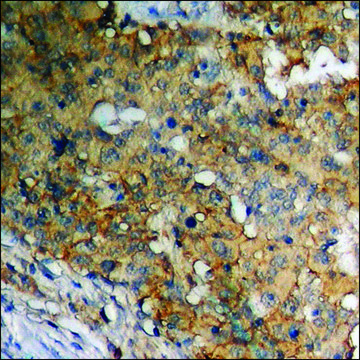 Anti-phospho-Adrenergic Receptor B2 (pSer355+Ser356) antibody produced in rabbit affinity isolated antibody