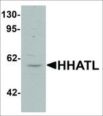 Anti-HHATL antibody produced in rabbit affinity isolated antibody