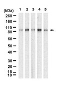 Anti-FKHR/FOXO1 Antibody, clone 1D21 ZooMAb&#174; Rabbit Monoclonal recombinant, expressed in HEK 293 cells