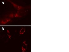 LentiBrite RFP-p62 Lentiviral Biosensor