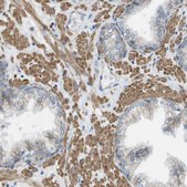 Anti-MYH11 antibody produced in rabbit Prestige Antibodies&#174; Powered by Atlas Antibodies, affinity isolated antibody, buffered aqueous glycerol solution