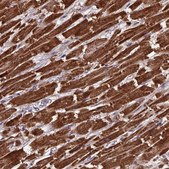 Anti-CS antibody produced in rabbit Prestige Antibodies&#174; Powered by Atlas Antibodies, affinity isolated antibody, buffered aqueous glycerol solution
