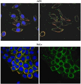 Anti-PORCN Antibody, clone 15G12.1 clone 15G12.1, from mouse