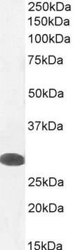 Anti-Tafazzin antibody produced in goat affinity isolated antibody, buffered aqueous solution