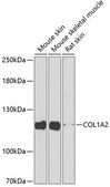 Anti-COL1A2 antibody produced in rabbit