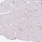 Anti-TNFRSF10A antibody produced in rabbit Prestige Antibodies&#174; Powered by Atlas Antibodies, affinity isolated antibody, buffered aqueous glycerol solution