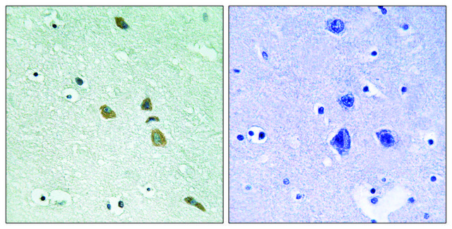 Anti-ILK antibody produced in rabbit affinity isolated antibody