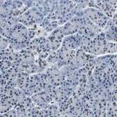Anti-BNIP3L antibody produced in rabbit Prestige Antibodies&#174; Powered by Atlas Antibodies, affinity isolated antibody, buffered aqueous glycerol solution