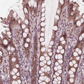 Anti-ZNF471 antibody produced in rabbit Prestige Antibodies&#174; Powered by Atlas Antibodies, affinity isolated antibody, buffered aqueous glycerol solution