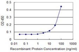 Monoclonal Anti-GSTT1 antibody produced in mouse clone 2D12-1C9, purified immunoglobulin, buffered aqueous solution