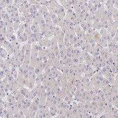 Anti-PPP2R2B antibody produced in rabbit Prestige Antibodies&#174; Powered by Atlas Antibodies, affinity isolated antibody, buffered aqueous glycerol solution