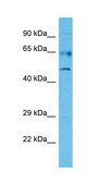 Anti-RARG antibody produced in rabbit affinity isolated antibody