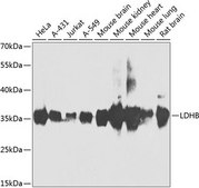 Anti-LDHB antibody produced in rabbit