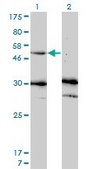 Monoclonal Anti-MMP13 antibody produced in mouse clone 3B11, purified immunoglobulin, buffered aqueous solution