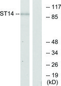 Anti-ST14, N-Terminal antibody produced in rabbit affinity isolated antibody