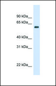 Anti-CAT antibody produced in rabbit affinity isolated antibody
