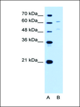 Anti-UGT1A4 antibody produced in rabbit affinity isolated antibody
