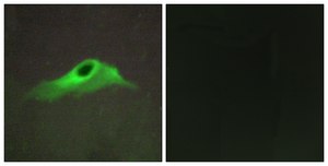Anti-Collagen IV α5 antibody produced in rabbit affinity isolated antibody