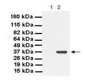 Anti-LDHB affinity isolated antibody