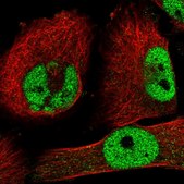 Anti-ZNF326 antibody produced in rabbit Prestige Antibodies&#174; Powered by Atlas Antibodies, affinity isolated antibody, buffered aqueous glycerol solution, ab2