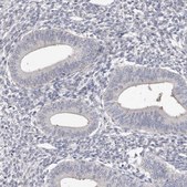 Anti-SPTA1 antibody produced in rabbit Prestige Antibodies&#174; Powered by Atlas Antibodies, affinity isolated antibody, buffered aqueous glycerol solution