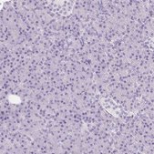 Anti-GFAP antibody produced in rabbit Prestige Antibodies® Powered by Atlas Antibodies, affinity isolated antibody, buffered aqueous glycerol solution