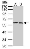 Anti-GPER (C-terminal) antibody produced in rabbit affinity isolated antibody, buffered aqueous solution