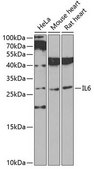 Anti-IL6 antibody produced in rabbit
