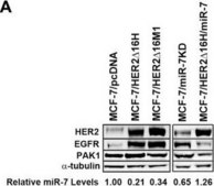 Anti-&#945;-Tubulin Antibody, clone DM1A clone DM1A, Upstate&#174;, from mouse