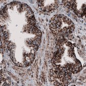 Monoclonal Anti-CS antibody produced in mouse Prestige Antibodies&#174; Powered by Atlas Antibodies, clone CL2548, purified immunoglobulin, buffered aqueous glycerol solution