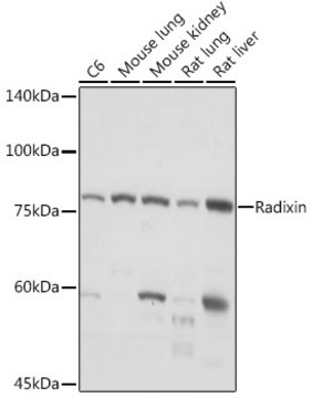 Anti-Radixin Antibody, clone 4U6W9, Rabbit Monoclonal