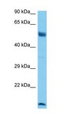 Anti-RUNX1 antibody produced in rabbit affinity isolated antibody