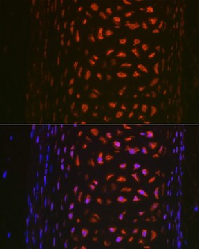 Anti- MMP13 antibody produced in rabbit