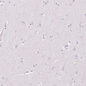 Anti-HSD17B2 antibody produced in rabbit Prestige Antibodies&#174; Powered by Atlas Antibodies, affinity isolated antibody, buffered aqueous glycerol solution