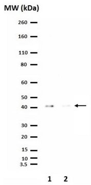 Anti-phospho-PDHE1-A type I (Ser293) Antibody from rabbit, purified by affinity chromatography
