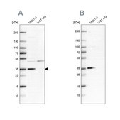 Anti-PCNA antibody produced in rabbit Prestige Antibodies&#174; Powered by Atlas Antibodies, affinity isolated antibody, buffered aqueous glycerol solution, ab1