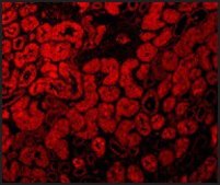 Anti-ACE2 antibody produced in rabbit affinity isolated antibody