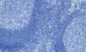 Anti-TYMS Antibody, clone 1E20 ZooMAb® Rabbit Monoclonal recombinant, expressed in HEK 293 cells