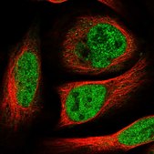 Anti-HOXC5 antibody produced in rabbit Prestige Antibodies&#174; Powered by Atlas Antibodies, affinity isolated antibody, buffered aqueous glycerol solution
