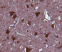 Anti-Homer1 Antibody from rabbit, purified by affinity chromatography