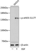 Anti-Phospho-eNOS-S1177 antibody produced in rabbit