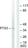 Anti-PTX3 antibody produced in rabbit affinity isolated antibody