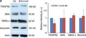 Anti-Actin, &#945;-Smooth Muscle - FITC antibody, Mouse monoclonal clone 1A4, purified from hybridoma cell culture