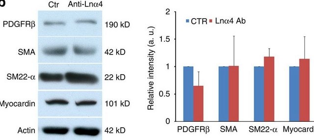 Anti-Actin, α-Smooth Muscle - FITC antibody, Mouse monoclonal clone 1A4, purified from hybridoma cell culture
