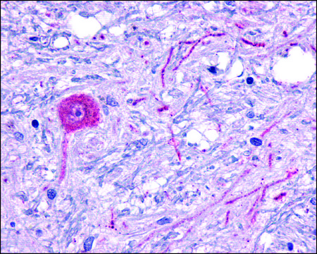 Anti-HTR6/5-HT36 antibody produced in rabbit affinity isolated antibody