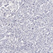 Anti-ABCC4 antibody produced in rabbit Prestige Antibodies&#174; Powered by Atlas Antibodies, affinity isolated antibody, buffered aqueous glycerol solution