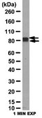 Anti-Dynamin related protein 1 (Drp1) Antibody from rabbit, purified by affinity chromatography