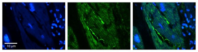 Anti-RB1CC1 antibody produced in rabbit affinity isolated antibody