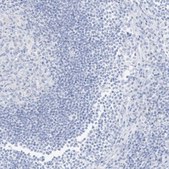 Anti-SLC22A13 antibody produced in rabbit Prestige Antibodies&#174; Powered by Atlas Antibodies, affinity isolated antibody, buffered aqueous glycerol solution