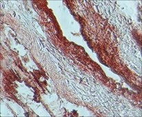 Anti-Guanylyl Cyclase &#946;1 (ER-19) antibody produced in rabbit affinity isolated antibody, buffered aqueous solution
